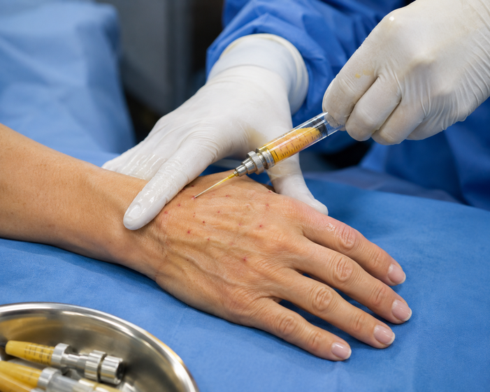 Surgeon consulting a patient about Fat Transfer to Hands